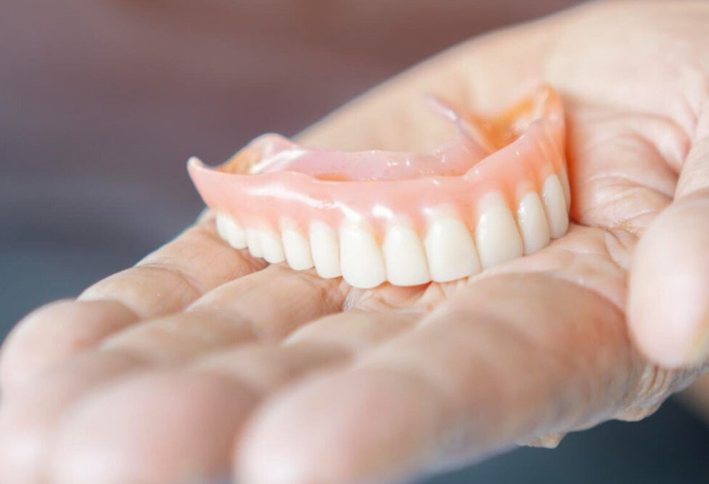 Plastic denture example