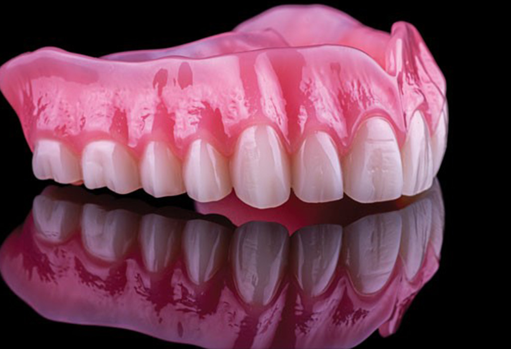Plastic denture fitting
