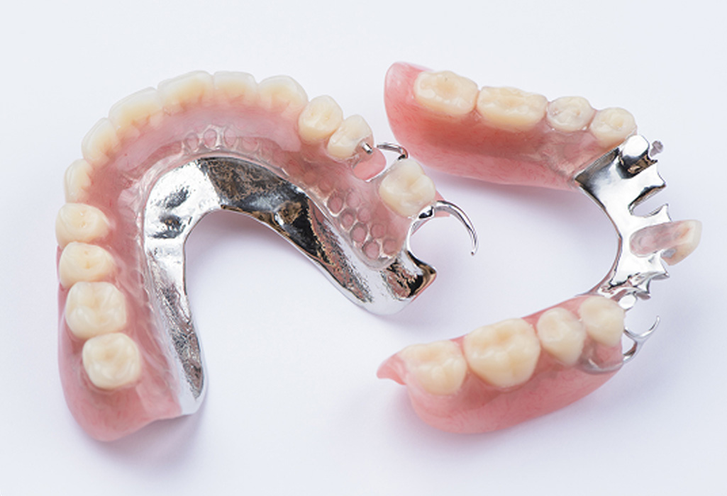 Metal chrome dentures example