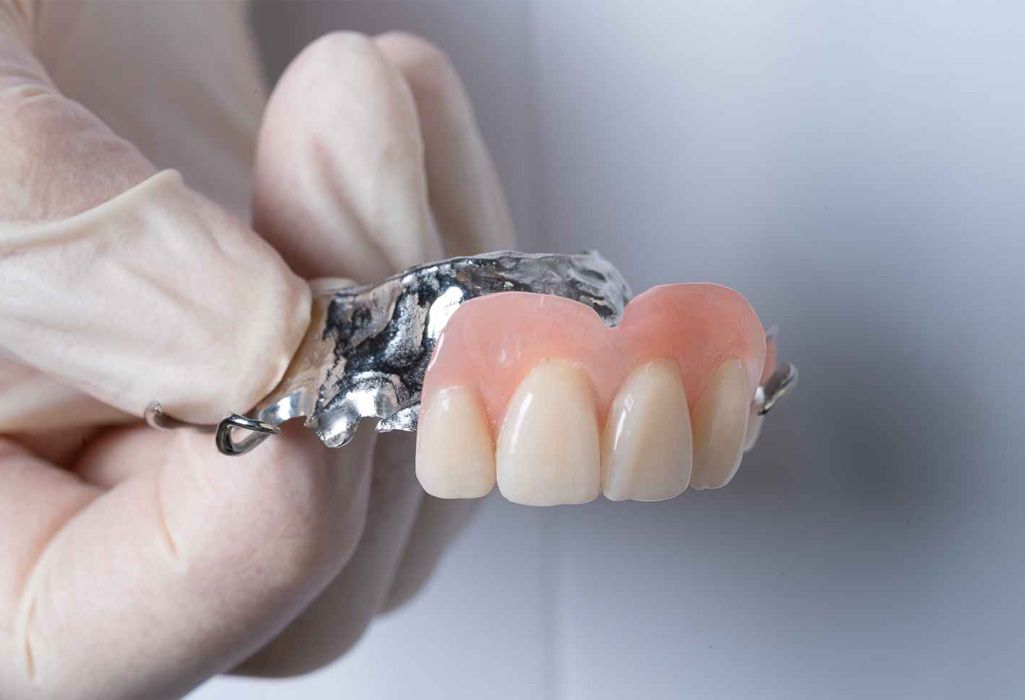 Chrome denture fitting