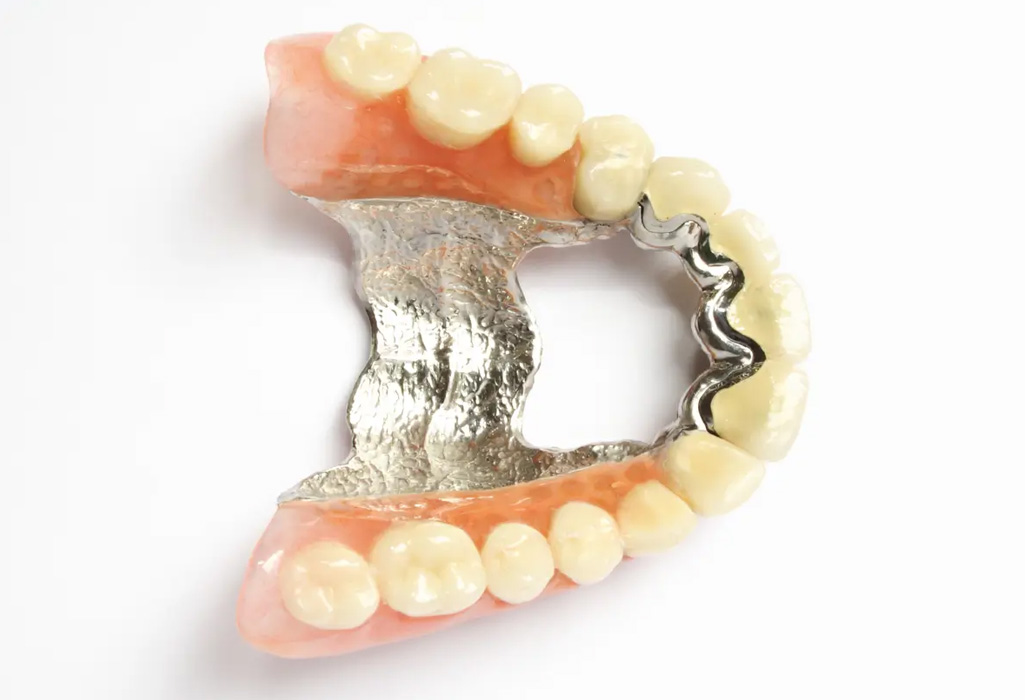 Chrome denture detail