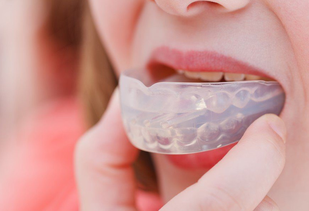 Custom mouthguard fitting