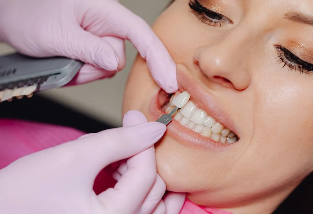 Dental restoration in progress